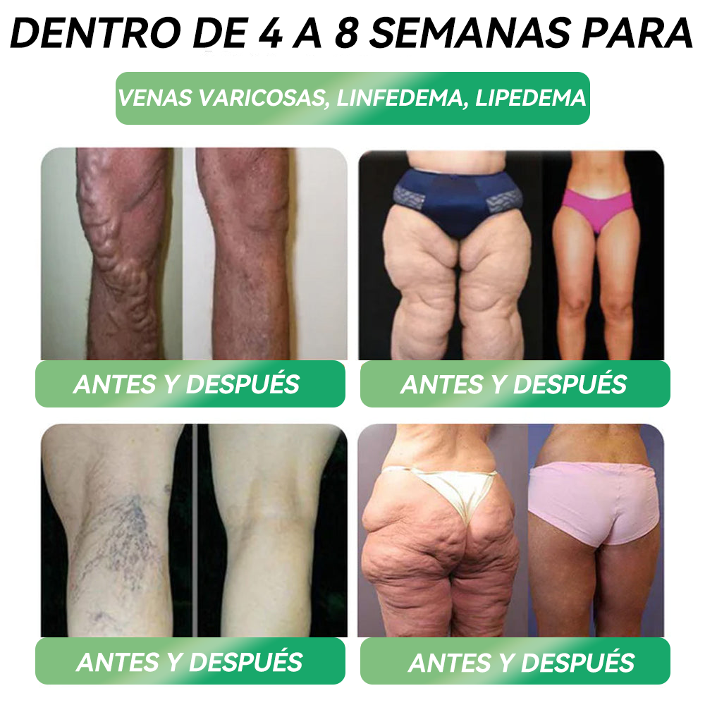 (HHVB®)  ¡Solo quedan 6 cajas! ¡Hoy obtén un 30% de descuento adicional! La Solución Oral GLP-1 está clínicamente comprobada para ayudar a controlar el peso y el azúcar en sangre, con resultados duraderos en tan solo 4 a 6 cajas.
